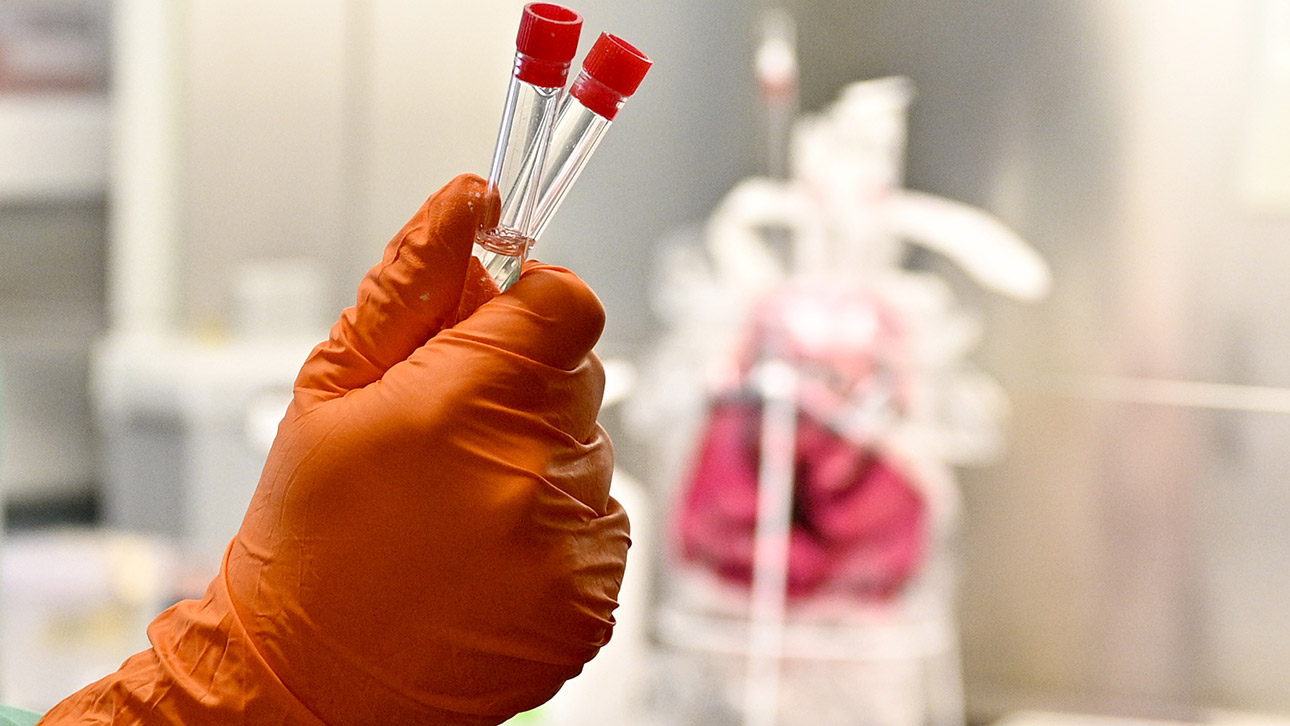 Eine Laboruntersuchung am Corona-Virus. Zu sehen ist eine Hand mit orangefarbenem Laborhandschuh, die zwei Proben hält.
