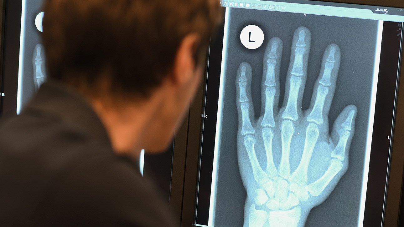 Alterstest Röntgen Flüchtlinge